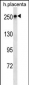 SCRIB Antibody (N-term)